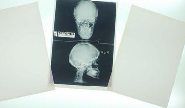 Good price medizinische Diagnosedarstellung von 11 x 14 Laser für Konida Laserdrucker Online