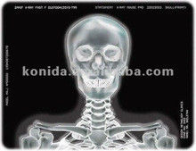 Good price Medizinische Röntgenthermische Druckerfolie KND-F25*30cm Online