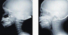 Good price Hohe Diagnosedarstellung der Tinten-Abdeckungs-X Ray, 35 x 43cm x-Strahl Film Lasers medizinischer Online