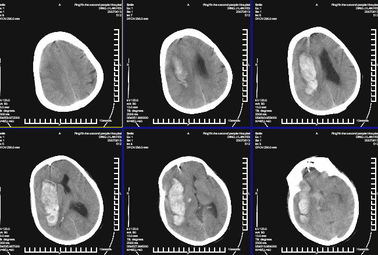 Good price Wasserdichte medizinische Diagnosedarstellung KND-K X Ray für Konida Laserdrucker Online