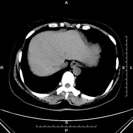 Good price Blaues Papier dünne Diagnosedarstellungs-Lasers Konida X Ray für Röntgenmaschine Online