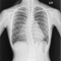 Good price Weißer niedriger medizinischer trockener Zoll X12 Filmes 10 Lasers X Ray abbaubar Online