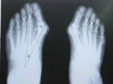 Good price Wasserdichte Darstellung X Ray Diagnostik Online