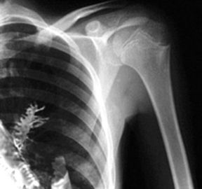 Medizinischer Röntgenfilm Agfa/Fujis, Radiographie-tragbarer Laserdrucker-Film