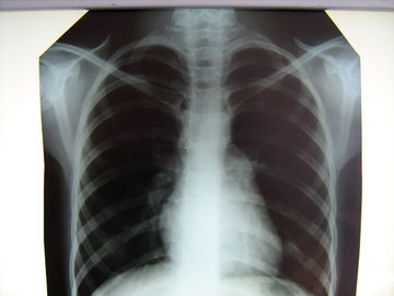 Good price Krankenhaus-klarer medizinischer Röntgenfilm Konida mit Thermal-Druckern Online