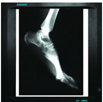 20cm x 25cm medizinische Diagnosedarstellung, Papier des Laserdrucker-Film-X Ray