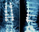 Blaues AGFA medizinisches X Ray filmt 10in x 12in, hohe Schärfe