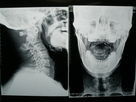 Good price Film mit hoher Dichte X Ray der medizinischen Bildgebung trocken für Fuji 3000/2000/1000 Online