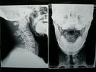 X Film Ray-medizinischer Bildgebung