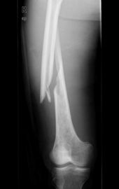 Medizinische Bildgebung Konida Lasers X Ray