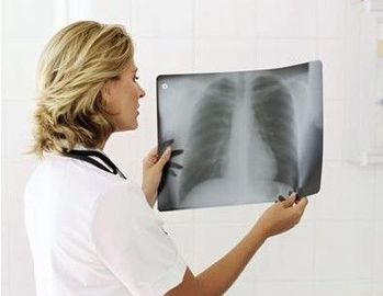 Good price 20 x 25cm Laserverdünnen medizinischer Diagnosedarstellungs-Film wasserdichtes Online