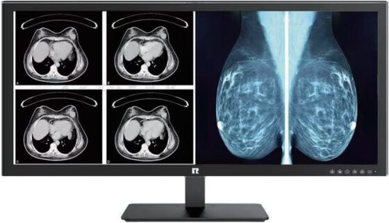 Ein guter Preis. High-Definition-Medizinische Anzeige mit DICOM-Konformität für Radiologie-Bildgebung Online