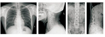 Mobile Digital-Radiographie-Hochfrequenzausrüstung, tragbare medizinische Geräte X Ray
