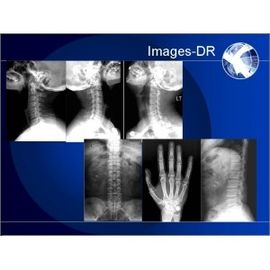 Radiographie-System 50kw Toshiba Digital