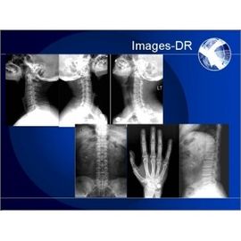 Good price Mammogrpahy-RÖNTGENSTRAHL Digital-Radiographie-Maschine mit flexiblem UC-Arm Online