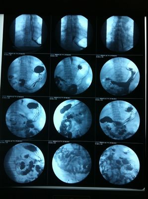 Good price Lichtdurchlässiger Siebdruck des Tintenstrahl-X Ray Film Glossy Surface Silk Online