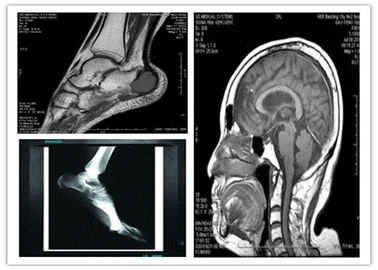 Good price Medizinischer blauer niedriger trockener Darstellungs-Film Digital 8 x 10in kompatibler Hosipital Mri Scan Online