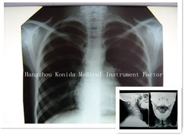 Good price Gesundheits-Darstellungs-Röntgenfilm Digital-medizinischer X Ray trockener Film-14 x 17inch Online