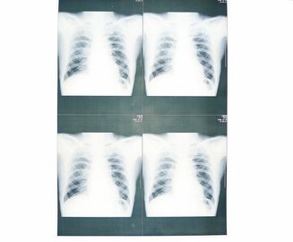 Good price Weißer niedriger medizinischer Papier-Film X Ray feuchtigkeitsfest für Laserdrucker Sony-/EPSON Online