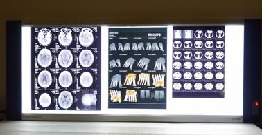 10in * 14in Digital Röntgenstrahl trockene Filme medizinischer Bildgebung für Thermal-Drucker KND-F
