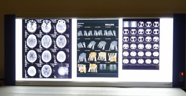 Good price Helle medizinische Film-Laser-Blau-Basis Thermal-Drucker X Ray trockene Online