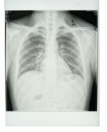Konida Laserdrucker-medizinischer Röntgenfilm 11in x 14in KND-K CER genehmigte