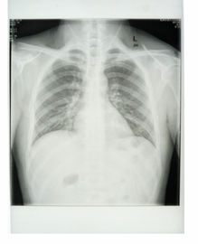 Good price Konida Laserdrucker-medizinischer Röntgenfilm 11in x 14in KND-K CER genehmigte Online