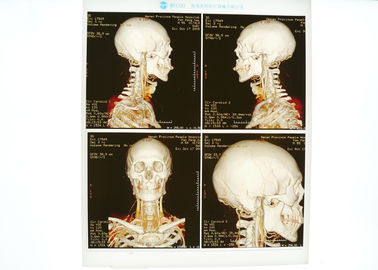 Good price Medizinisches Film-Blau X Ray mit hoher Dichte für Konida Laserdrucker Online