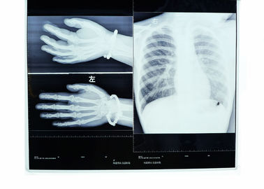 Good price Niedriger Nebel 14in * 17in Röntgenstrahl-Transparenz-Thermal-Drucker Film medizinischer Bildgebung trockener Online