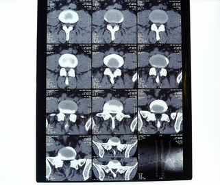 Good price 8in* 10in 14in * 17in medizinischer Röntgenstrahl-mit hoher Dichte trockener Thermal-Drucker Film Online