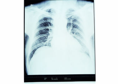 Good price Trockene medizinische Diagnosedarstellungs-Radiologie X Ray für AGFA/FUJI 2000 Online