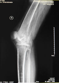 Good price KND-A niedriger Nebel-medizinischer trockener Darstellungs-Film für Prüfung X Ray auf AGFA 5300, 5302, 5500 Online