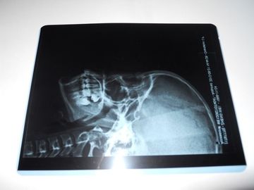 Niedriger Nebel-medizinischer trockener Darstellungs-Film Konida für Prüfung X Ray