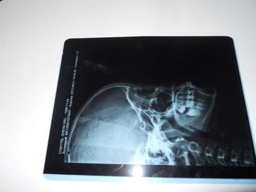 Good price KND-A umweltfreundlicher medizinischer trockener Darstellungs-Film für Prüfung X Ray auf AGFA 5300 Online
