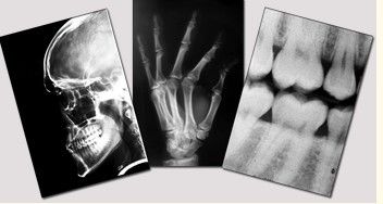 Good price Blauer medizinischer trockener Darstellungs-Film, 11in x 14in Film Lasers Fuji X Ray Online